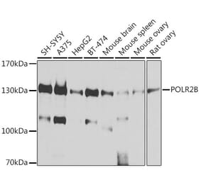 Western Blot - Anti-RPB2 Antibody (A15056) - Antibodies.com