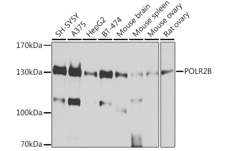 Western Blot - Anti-RPB2 Antibody (A15056) - Antibodies.com