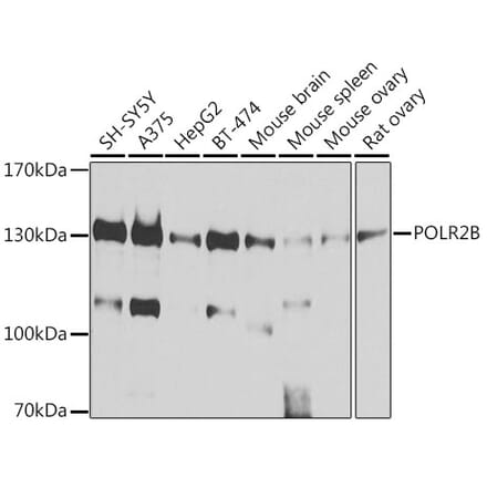 Western Blot - Anti-RPB2 Antibody (A15056) - Antibodies.com