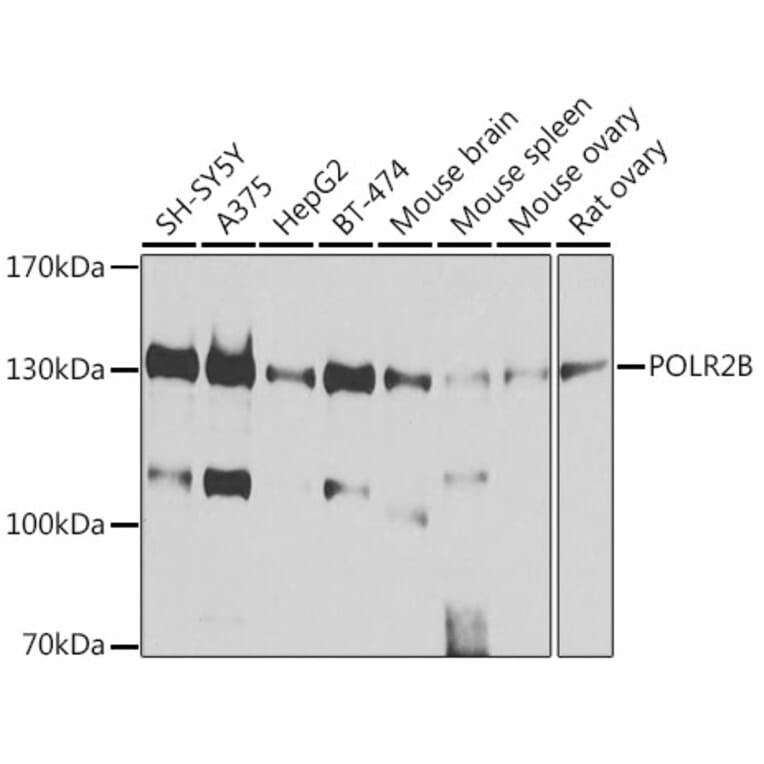 Western Blot - Anti-RPB2 Antibody (A15056) - Antibodies.com