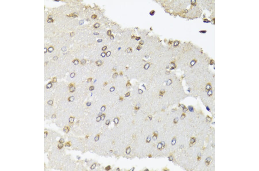 Immunohistochemistry - Anti-RPB2 Antibody (A15056) - Antibodies.com