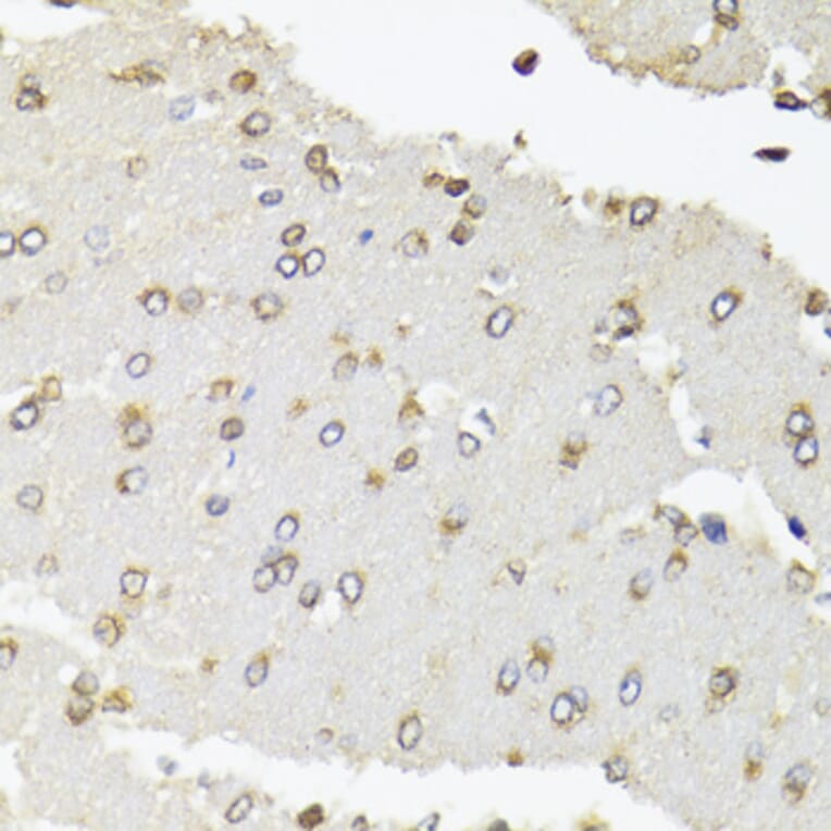 Immunohistochemistry - Anti-RPB2 Antibody (A15056) - Antibodies.com