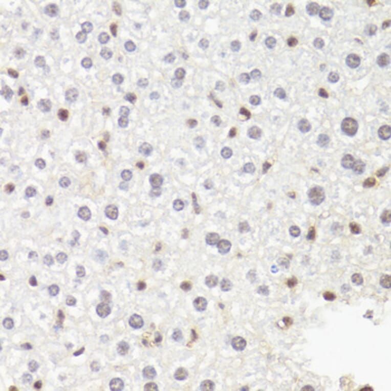 Immunohistochemistry - Anti-RPB2 Antibody (A15056) - Antibodies.com