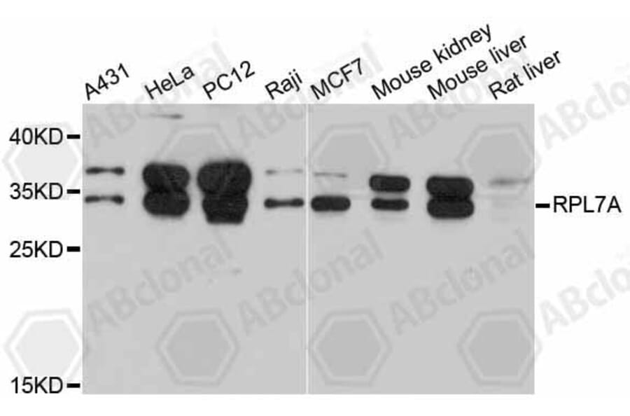 Western Blot - Anti-RPL7A Antibody (A5933) - Antibodies.com