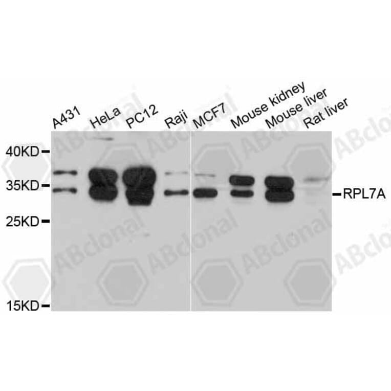 Western Blot - Anti-RPL7A Antibody (A5933) - Antibodies.com