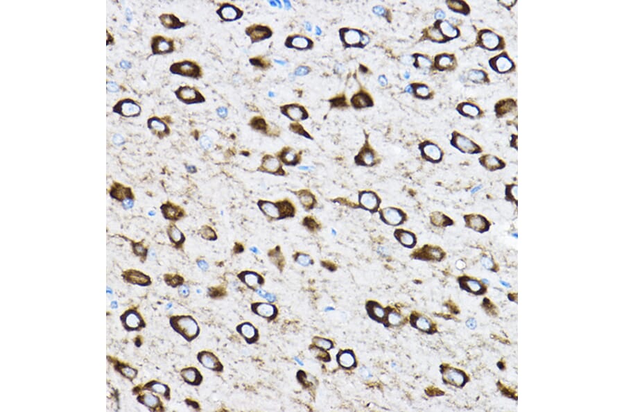 Immunohistochemistry - Anti-RPL17 Antibody (A15058) - Antibodies.com