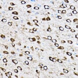 Immunohistochemistry - Anti-RPL17 Antibody (A15058) - Antibodies.com