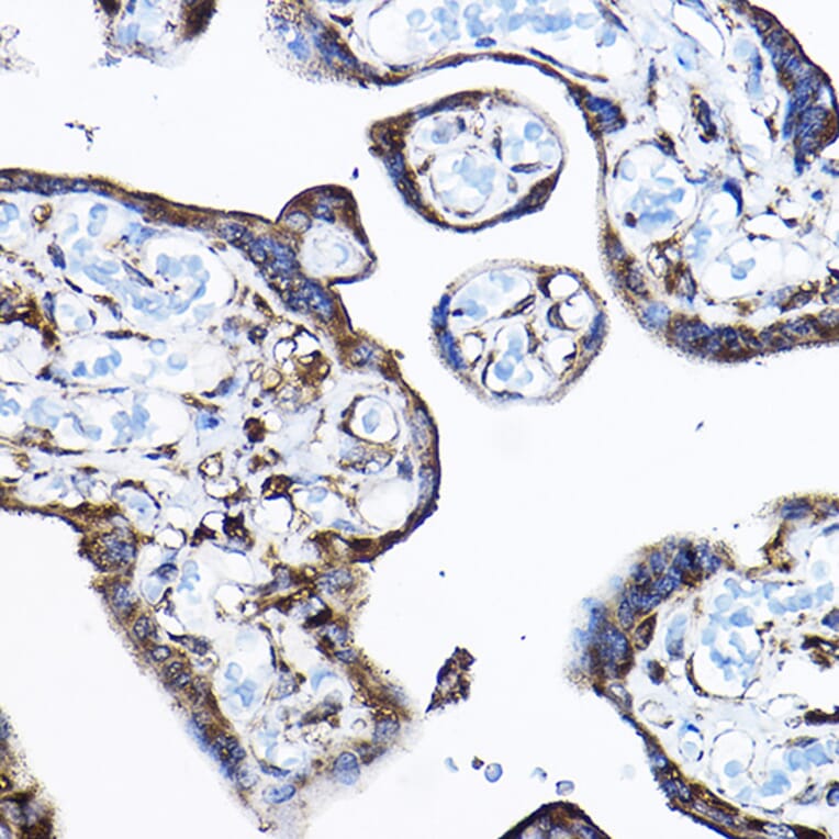 Immunohistochemistry - Anti-RPL17 Antibody (A15058) - Antibodies.com