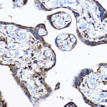 Immunohistochemistry - Anti-RPL17 Antibody (A15058) - Antibodies.com