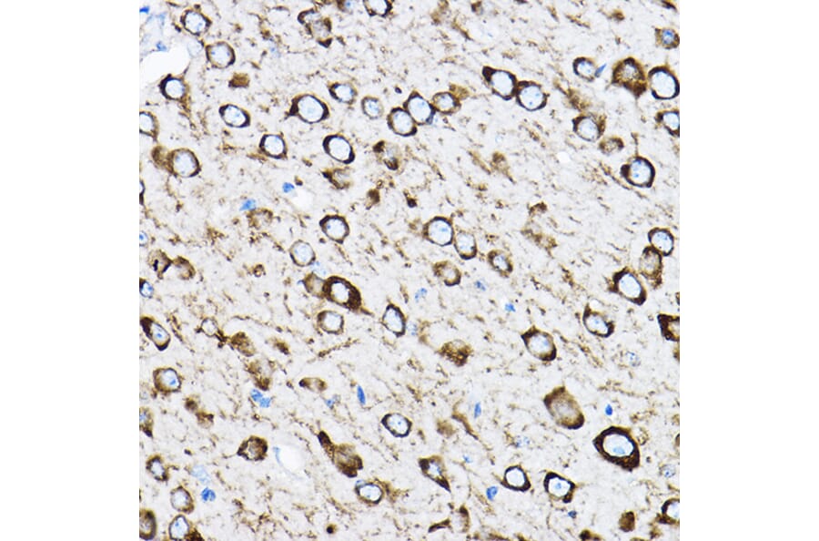 Immunohistochemistry - Anti-RPL17 Antibody (A15058) - Antibodies.com
