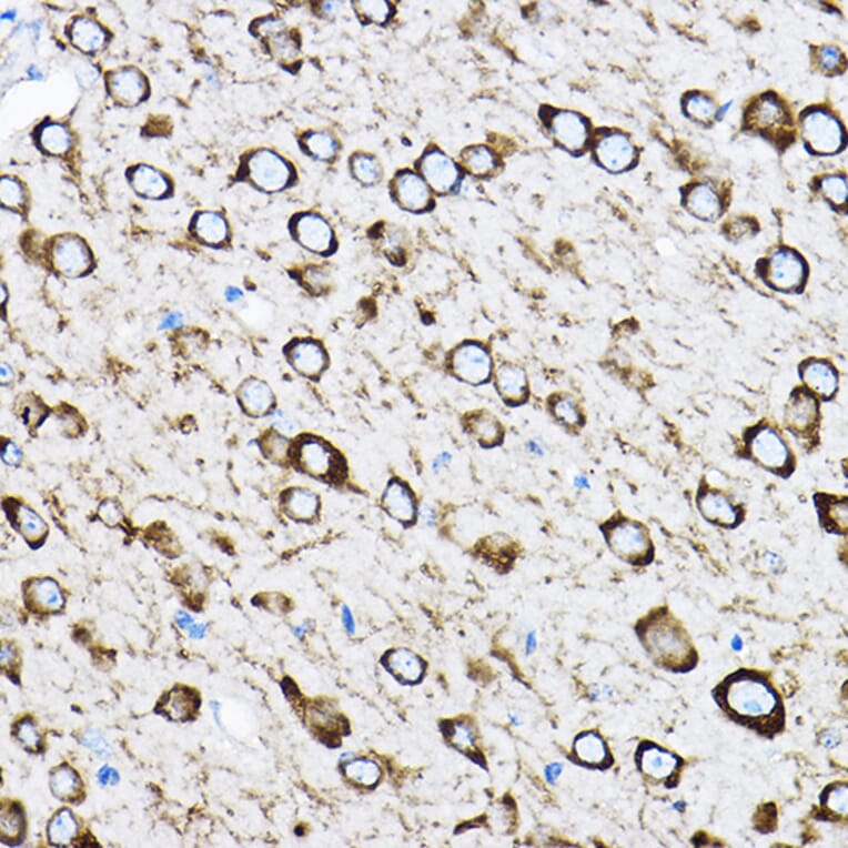 Immunohistochemistry - Anti-RPL17 Antibody (A15058) - Antibodies.com