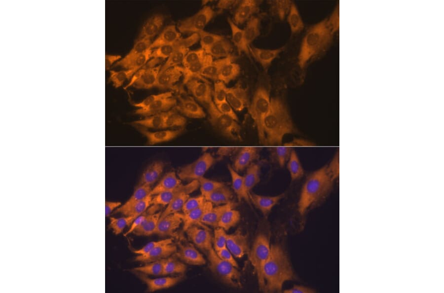 Immunofluorescence - Anti-RPL17 Antibody (A15058) - Antibodies.com