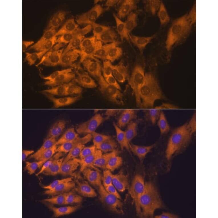 Immunofluorescence - Anti-RPL17 Antibody (A15058) - Antibodies.com