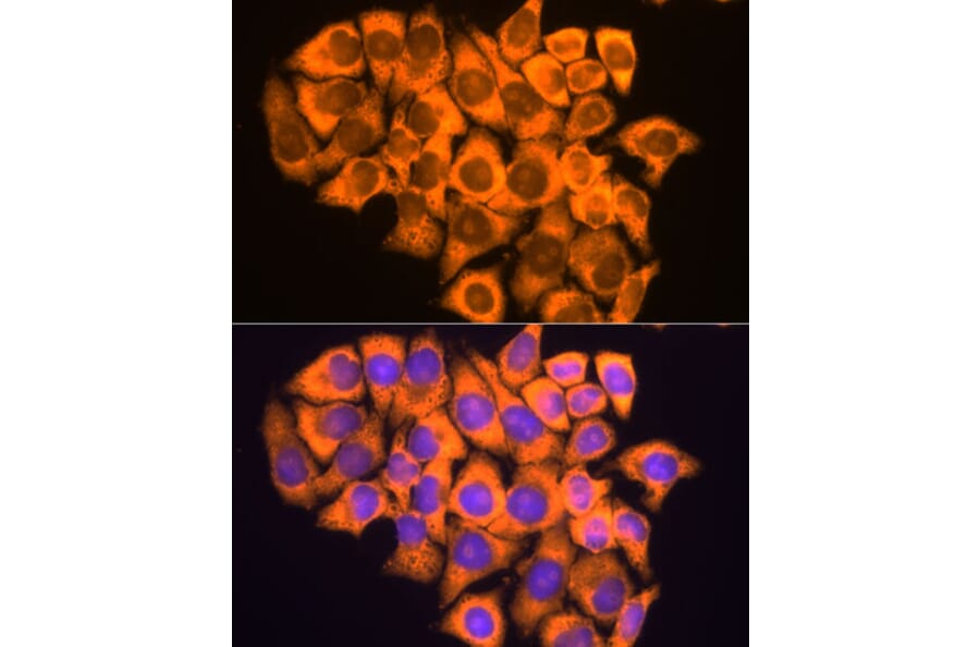 Immunofluorescence - Anti-RPL17 Antibody (A15058) - Antibodies.com