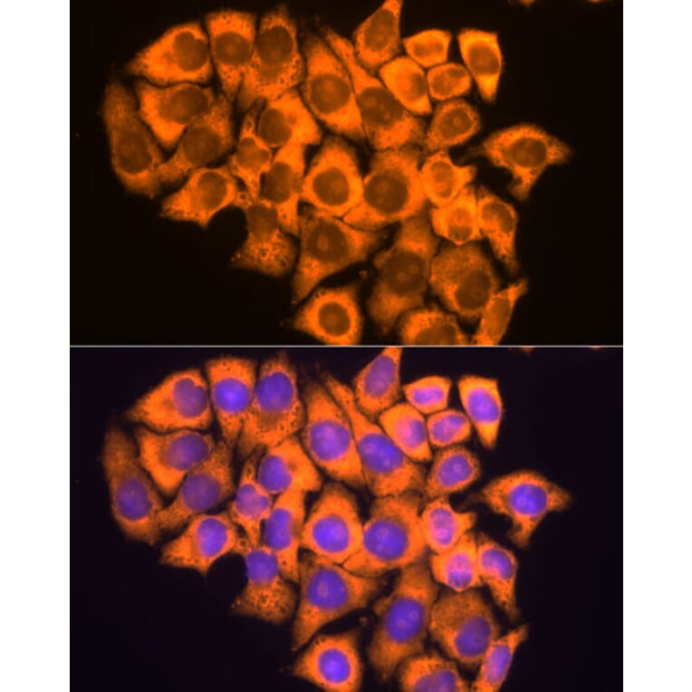 Immunofluorescence - Anti-RPL17 Antibody (A15058) - Antibodies.com