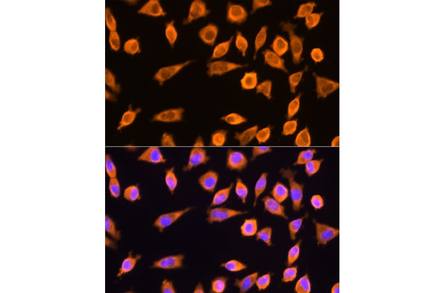 Immunofluorescence - Anti-RPL17 Antibody (A15058) - Antibodies.com