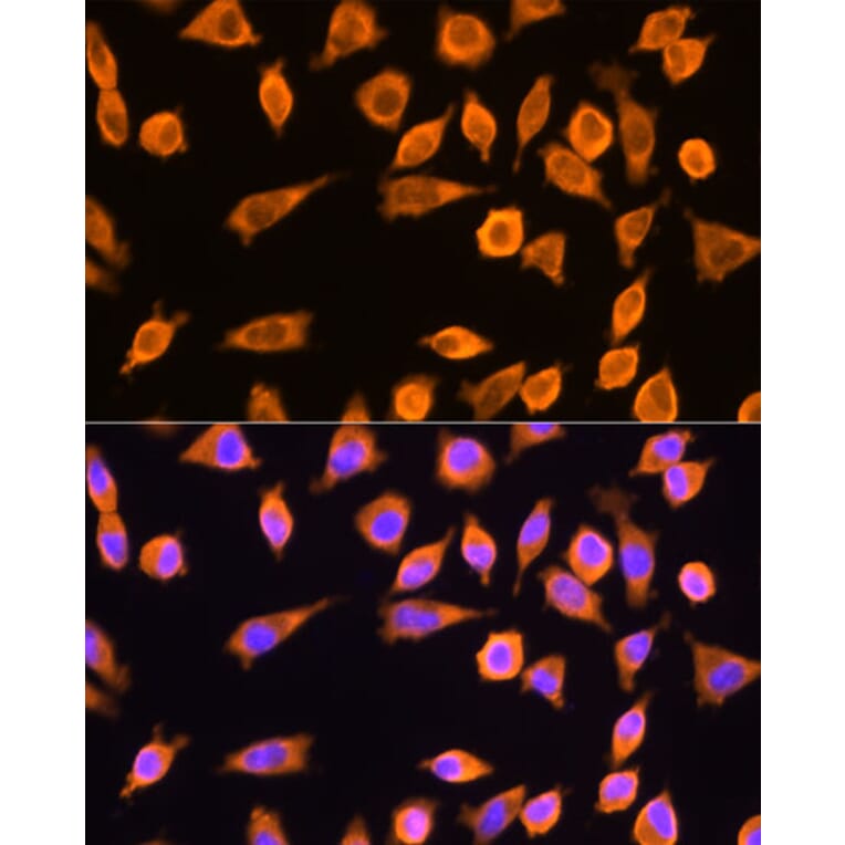 Immunofluorescence - Anti-RPL17 Antibody (A15058) - Antibodies.com