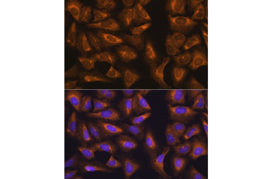 Immunofluorescence - Anti-RPL17 Antibody (A15058) - Antibodies.com
