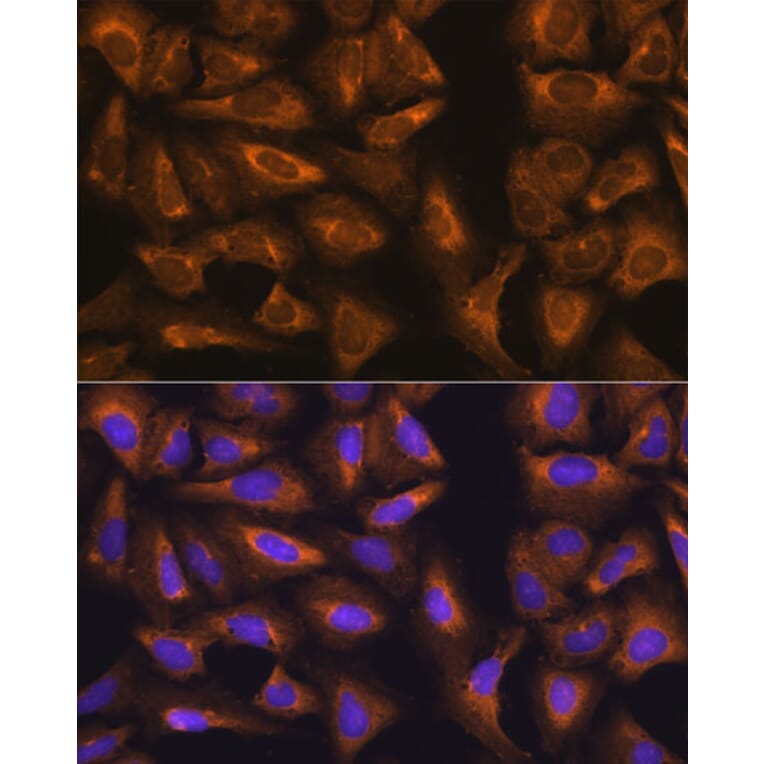 Immunofluorescence - Anti-RPL17 Antibody (A15058) - Antibodies.com