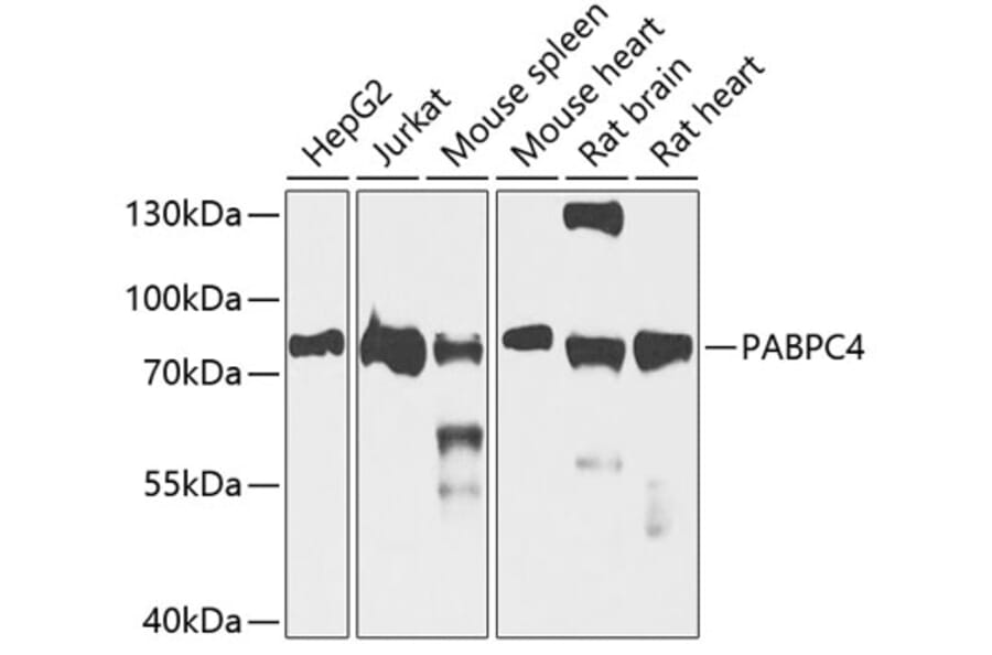 Western Blot - Anti-APP-1 Antibody (A15060) - Antibodies.com
