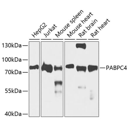 Western Blot - Anti-APP-1 Antibody (A15060) - Antibodies.com