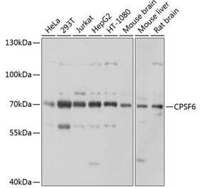 Western Blot - Anti-CPSF6 Antibody (A15061) - Antibodies.com