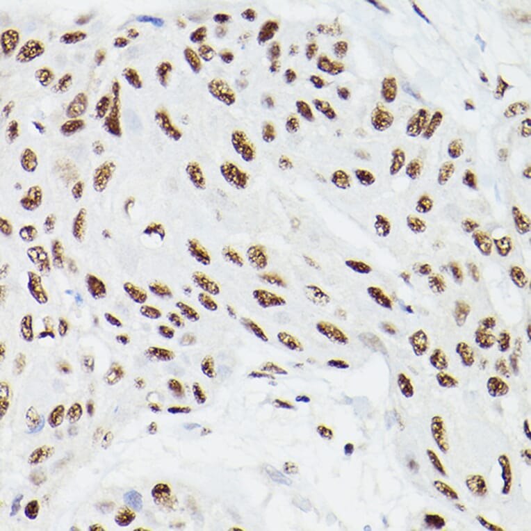 Immunohistochemistry - Anti-CPSF6 Antibody (A15061) - Antibodies.com