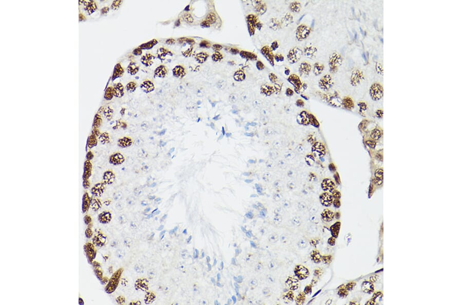 Immunohistochemistry - Anti-CPSF6 Antibody (A15061) - Antibodies.com