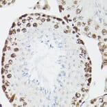Immunohistochemistry - Anti-CPSF6 Antibody (A15061) - Antibodies.com
