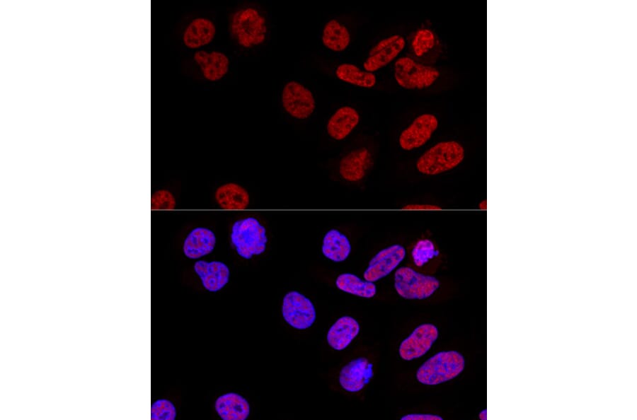 Immunofluorescence - Anti-CPSF6 Antibody (A15061) - Antibodies.com