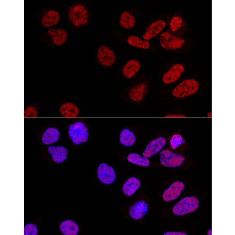 Immunofluorescence - Anti-CPSF6 Antibody (A15061) - Antibodies.com
