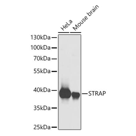 Western Blot - Anti-Unrip Antibody (A15062) - Antibodies.com