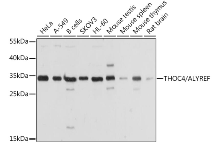 Western Blot - Anti-Aly/Ref Antibody (A15063) - Antibodies.com