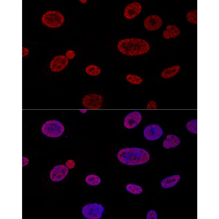 Immunofluorescence - Anti-Aly/Ref Antibody (A15063) - Antibodies.com