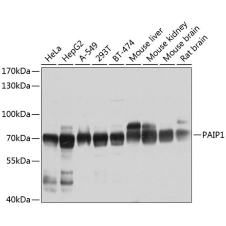 Western Blot - Anti-PAIP1 Antibody (A15067) - Antibodies.com