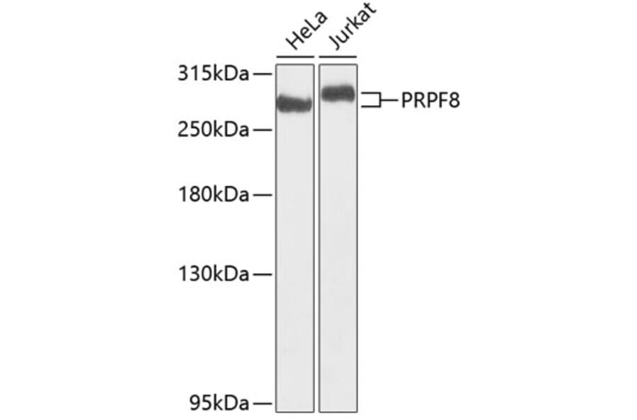 Western Blot - Anti-PRPF8/Prp8 Antibody (A15068) - Antibodies.com