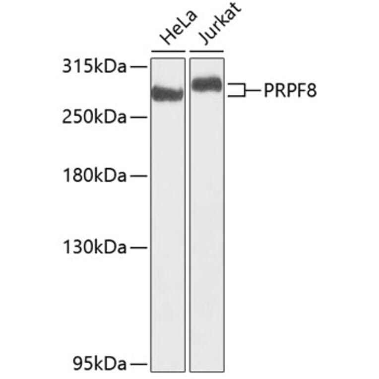 Western Blot - Anti-PRPF8/Prp8 Antibody (A15068) - Antibodies.com
