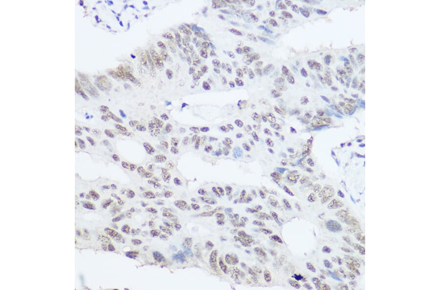 Immunohistochemistry - Anti-PRPF8/Prp8 Antibody (A15068) - Antibodies.com