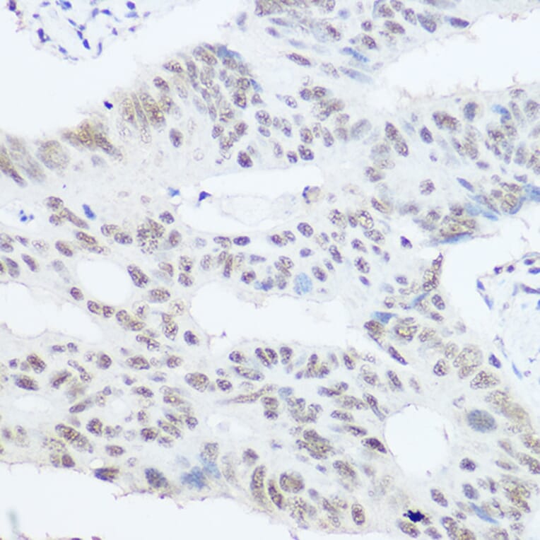 Immunohistochemistry - Anti-PRPF8/Prp8 Antibody (A15068) - Antibodies.com