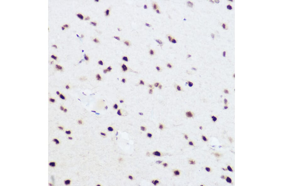 Immunohistochemistry - Anti-PRPF8/Prp8 Antibody (A15068) - Antibodies.com