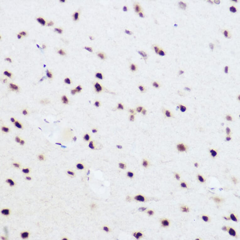 Immunohistochemistry - Anti-PRPF8/Prp8 Antibody (A15068) - Antibodies.com