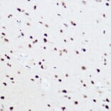 Immunohistochemistry - Anti-PRPF8/Prp8 Antibody (A15068) - Antibodies.com