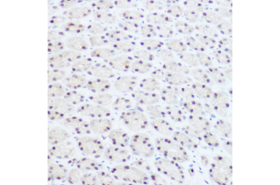 Immunohistochemistry - Anti-PRPF8/Prp8 Antibody (A15068) - Antibodies.com