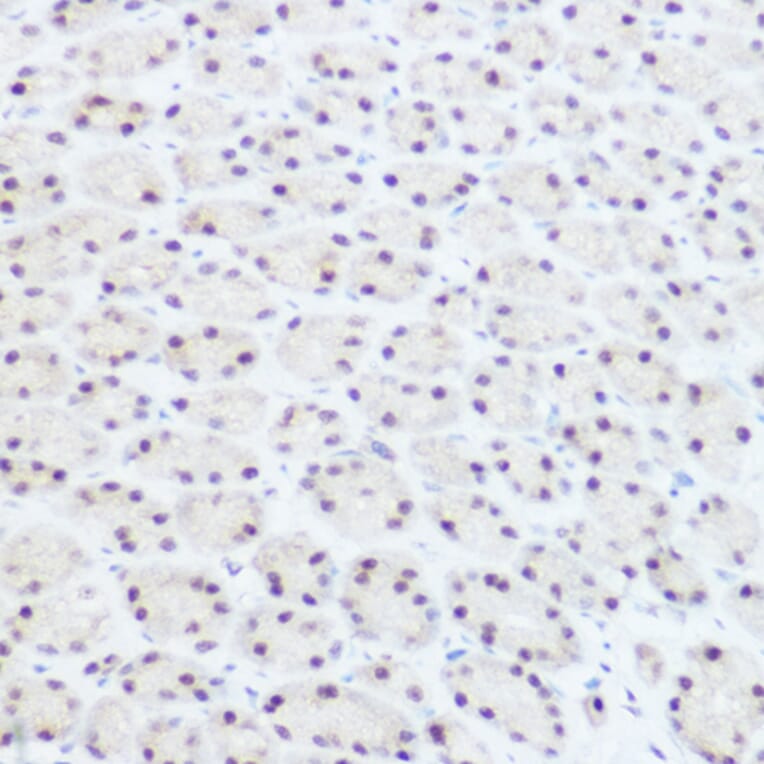 Immunohistochemistry - Anti-PRPF8/Prp8 Antibody (A15068) - Antibodies.com