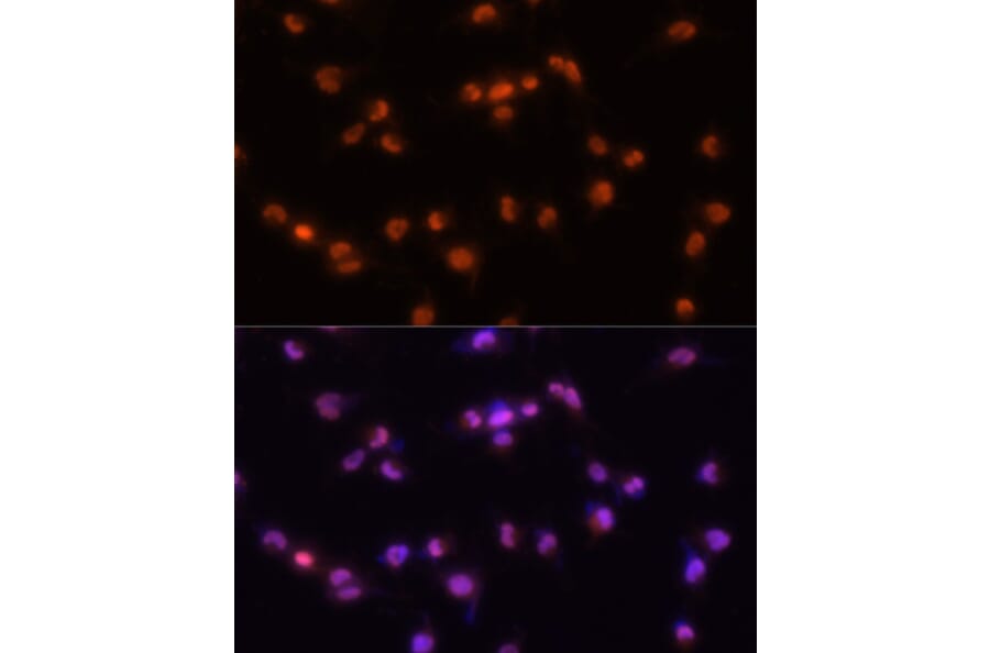 Immunofluorescence - Anti-PRPF8/Prp8 Antibody (A15068) - Antibodies.com