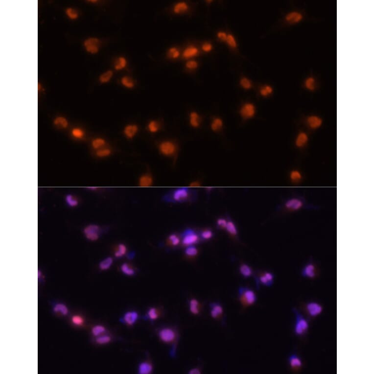 Immunofluorescence - Anti-PRPF8/Prp8 Antibody (A15068) - Antibodies.com