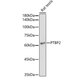 Western Blot - Anti-PTBP2 Antibody (A15069) - Antibodies.com