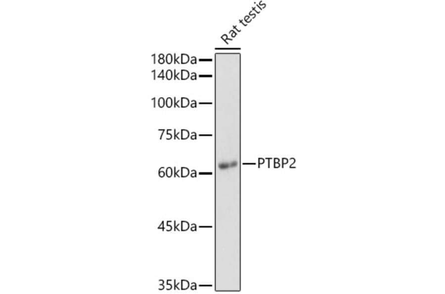 Western Blot - Anti-PTBP2 Antibody (A15069) - Antibodies.com
