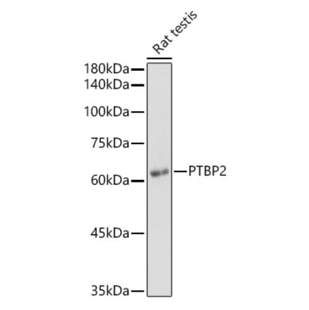 Western Blot - Anti-PTBP2 Antibody (A15069) - Antibodies.com