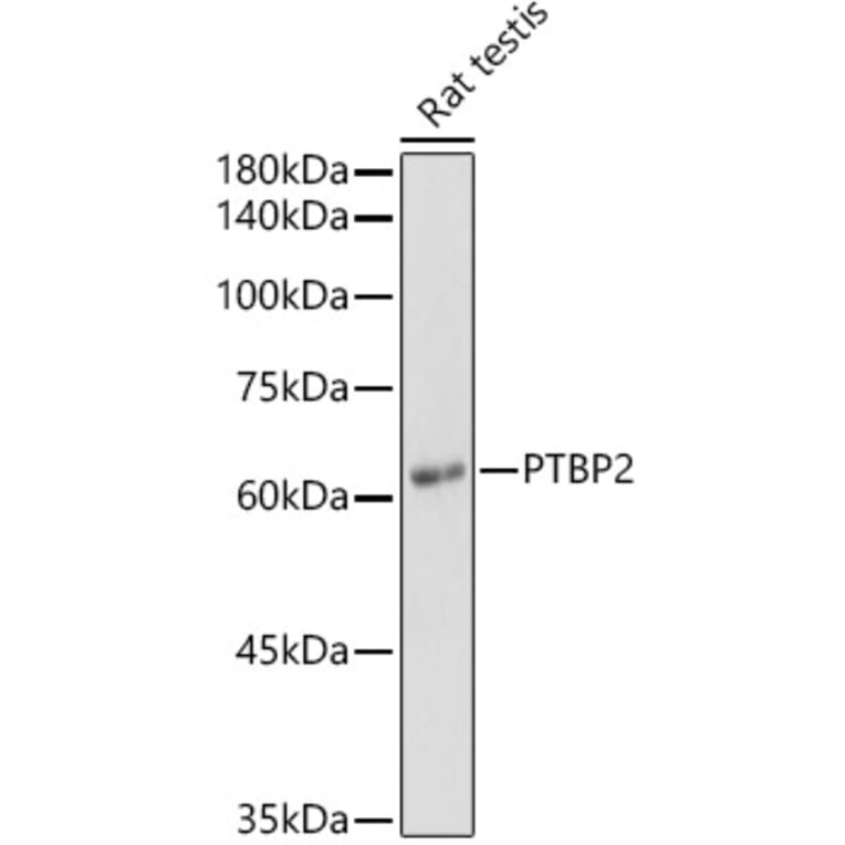 Western Blot - Anti-PTBP2 Antibody (A15069) - Antibodies.com